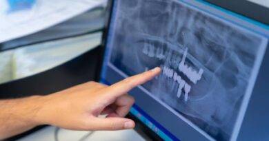 radiologia odontológica digital